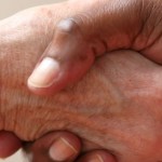 Personal Support Worker